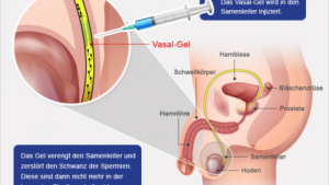 vacuna-anticonceptiva-para-hombres2-2d4ab